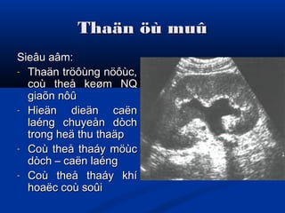 Thaän öù muûThaän öù muû
Sieâu aâm:Sieâu aâm:
- Thaän tröôùng nöôùc,Thaän tröôùng nöôùc,
coù theå keøm NQcoù theå keøm NQ
giaõn nôûgiaõn nôû
- Hieän dieän caënHieän dieän caën
laéng chuyeån dòchlaéng chuyeån dòch
trong heä thu thaäptrong heä thu thaäp
- Coù theå thaáy möùcCoù theå thaáy möùc
dòch – caën laéngdòch – caën laéng
- Coù theå thaáy khíCoù theå thaáy khí
hoaëc coù soûihoaëc coù soûi
 