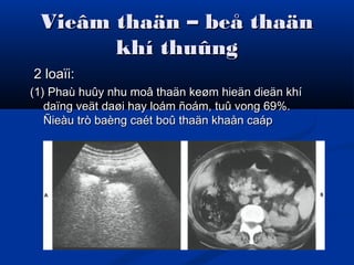 Vieâm thaän – beå thaänVieâm thaän – beå thaän
khí thuûngkhí thuûng
2 loaïi:2 loaïi:
(1) Phaù huûy nhu moâ thaän keøm hieän dieän khí(1) Phaù huûy nhu moâ thaän keøm hieän dieän khí
daïng veät daøi hay loám ñoám, tuû vong 69%.daïng veät daøi hay loám ñoám, tuû vong 69%.
Ñieàu trò baèng caét boû thaän khaån caápÑieàu trò baèng caét boû thaän khaån caáp
 