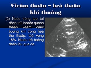 Vieâm thaän – beå thaänVieâm thaän – beå thaän
khí thuûngkhí thuûng
(2) Ñaëc tröng laø tuï(2) Ñaëc tröng laø tuï
dòch taïi hoaëc quanhdòch taïi hoaëc quanh
thaän keøm caùcthaän keøm caùc
boùng khí trong heäboùng khí trong heä
thu thaäp, töû vongthu thaäp, töû vong
18%. Ñieàu trò baèng18%. Ñieàu trò baèng
daãn löu qua da.daãn löu qua da.
 