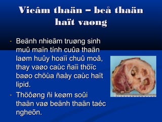 Vieâm thaän – beå thaänVieâm thaän – beå thaän
haït vaønghaït vaøng
- Beänh nhieãm truøng sinhBeänh nhieãm truøng sinh
muû maïn tính cuûa thaänmuû maïn tính cuûa thaän
laøm huûy hoaïi chuû moâ,laøm huûy hoaïi chuû moâ,
thay vaøo caùc ñaïi thöïcthay vaøo caùc ñaïi thöïc
baøo chöùa ñaày caùc haïtbaøo chöùa ñaày caùc haït
lipid.lipid.
- Thöôøng ñi keøm soûiThöôøng ñi keøm soûi
thaän vaø beänh thaän taécthaän vaø beänh thaän taéc
ngheõn.ngheõn.
 