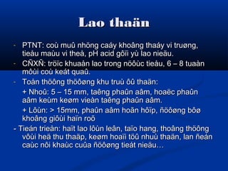 Lao thaänLao thaän
- PTNT: coù muû nhöng caáy khoâng thaáy vi truøng,PTNT: coù muû nhöng caáy khoâng thaáy vi truøng,
tieåu maùu vi theå, pH acid gôïi yù lao nieäu.tieåu maùu vi theå, pH acid gôïi yù lao nieäu.
- CÑXÑ: tröïc khuaån lao trong nöôùc tieåu, 6 – 8 tuaànCÑXÑ: tröïc khuaån lao trong nöôùc tieåu, 6 – 8 tuaàn
môùi coù keát quaû.môùi coù keát quaû.
- Toån thöông thöôøng khu truù ôû thaän:Toån thöông thöôøng khu truù ôû thaän:
+ Nhoû: 5 – 15 mm, taêng phaûn aâm, hoaëc phaûn+ Nhoû: 5 – 15 mm, taêng phaûn aâm, hoaëc phaûn
aâm keùm keøm vieàn taêng phaûn aâm.aâm keùm keøm vieàn taêng phaûn aâm.
+ Lôùn: > 15mm, phaûn aâm hoãn hôïp, ñöôøng bôø+ Lôùn: > 15mm, phaûn aâm hoãn hôïp, ñöôøng bôø
khoâng giôùi haïn roõkhoâng giôùi haïn roõ
- Tieán trieån: haït lao lôùn leân, taïo hang, thoâng thöông- Tieán trieån: haït lao lôùn leân, taïo hang, thoâng thöông
vôùi heä thu thaäp, keøm hoaïi töû nhuù thaän, lan ñeánvôùi heä thu thaäp, keøm hoaïi töû nhuù thaän, lan ñeán
caùc nôi khaùc cuûa ñöôøng tieát nieäu…caùc nôi khaùc cuûa ñöôøng tieát nieäu…
 