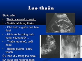 Lao thaänLao thaän
Sieâu aâm:Sieâu aâm:
• **Thaän vaø nieäu quaûn:Thaän vaø nieäu quaûn:
• - Voâi hoaù trong thaän- Voâi hoaù trong thaän
• - Chít heïp = giaõn heä beå- Chít heïp = giaõn heä beå
ñaøiñaøi
• - Hình aûnh coäng: taïo- Hình aûnh coäng: taïo
hang, xoang tuûy…hang, xoang tuûy…
• - Thaän teo nhoû, voâi- Thaän teo nhoû, voâi
hoaùhoaù
• ** Baøng quang :Baøng quang : daøydaøy
vaùchvaùch
Öu theá UIV trong lao nieäuÖu theá UIV trong lao nieäu
SA giuùp ích höôùng daãnSA giuùp ích höôùng daãn
 