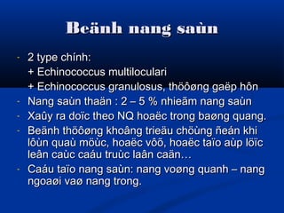Beänh nang saùnBeänh nang saùn
- 2 type chính:2 type chính:
+ Echinococcus multiloculari+ Echinococcus multiloculari
+ Echinococcus granulosus, thöôøng gaëp hôn+ Echinococcus granulosus, thöôøng gaëp hôn
- Nang saùn thaän : 2 – 5 % nhieãm nang saùnNang saùn thaän : 2 – 5 % nhieãm nang saùn
- Xaûy ra doïc theo NQ hoaëc trong baøng quang.Xaûy ra doïc theo NQ hoaëc trong baøng quang.
- Beänh thöôøng khoâng trieäu chöùng ñeán khiBeänh thöôøng khoâng trieäu chöùng ñeán khi
lôùn quaù möùc, hoaëc vôõ, hoaëc taïo aùp löïclôùn quaù möùc, hoaëc vôõ, hoaëc taïo aùp löïc
leân caùc caáu truùc laân caän…leân caùc caáu truùc laân caän…
- Caáu taïo nang saùn: nang voøng quanh – nangCaáu taïo nang saùn: nang voøng quanh – nang
ngoaøi vaø nang trong.ngoaøi vaø nang trong.
 