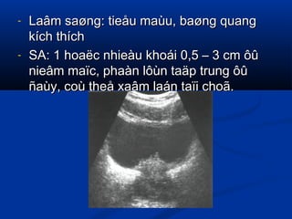 - Laâm saøng: tieåu maùu, baøng quangLaâm saøng: tieåu maùu, baøng quang
kích thíchkích thích
- SA: 1 hoaëc nhieàu khoái 0,5 – 3 cm ôûSA: 1 hoaëc nhieàu khoái 0,5 – 3 cm ôû
nieâm maïc, phaàn lôùn taäp trung ôûnieâm maïc, phaàn lôùn taäp trung ôû
ñaùy, coù theå xaâm laán taïi choã.ñaùy, coù theå xaâm laán taïi choã.
 