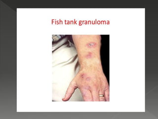 Fish Tank Rash NTM | PPTX