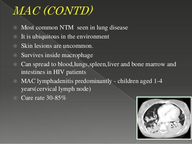 Clomid buy online no prescription