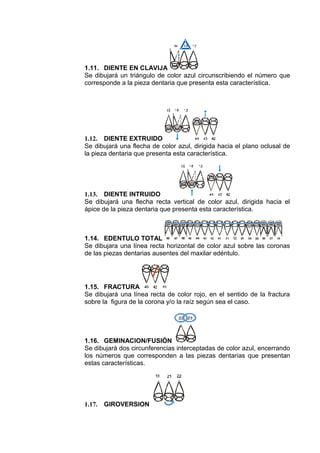 1.11. DIENTE EN CLAVIJA
Se dibujará un triángulo de color azul circunscribiendo el número que
corresponde a la pieza dentaria que presenta esta característica.

1.12. DIENTE EXTRUIDO
Se dibujará una flecha de color azul, dirigida hacia el plano oclusal de
la pieza dentaria que presenta esta característica.

1.13. DIENTE INTRUIDO
Se dibujará una flecha recta vertical de color azul, dirigida hacia el
ápice de la pieza dentaria que presenta esta característica.

1.14. EDENTULO TOTAL
Se dibujara una línea recta horizontal de color azul sobre las coronas
de las piezas dentarias ausentes del maxilar edéntulo.

1.15. FRACTURA
Se dibujará una línea recta de color rojo, en el sentido de la fractura
sobre la figura de la corona y/o la raíz según sea el caso.

1.16. GEMINACION/FUSIÓN
Se dibujará dos circunferencias interceptadas de color azul, encerrando
los números que corresponden a las piezas dentarias que presentan
estas características.

1.17.

GIROVERSION

 