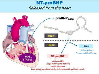 NT-proBNP
Released from the heart
NT-proBNP
BNP
Blood
Inactive protein
Longer half life (60 to 120 min)
Higher sensitivity
Level directly correlates with level of overstretching of heart muscle
Active protein
Shorter half life (20 min)
 WALL
STRESS
proBNP1-108
Heart
 