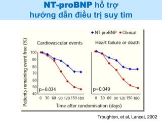 NT-proBNP hỗ trợ
hướng dẫn điều trị suy tim
Troughton, et al, Lancet, 2002
 