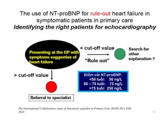Điểm cắt của NT-proBNP trong đánh giá khó thở tại Phòng
khám
EHJ 2010
The International Collaborative study of Natriuretic peptides in Primary Care (ICON-PC), EHJ
2010 57
Điểm cắt NT-proBNP:
<50 tuổi: 50 ng/L
50 – 75 tuổi: 75 ng/L
>75 tuổi: 250 ng/L
 