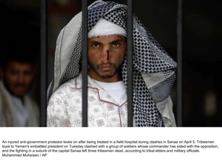 An injured anti-government protestor looks on after being treated in a field hospital during clashes in Sanaa on April 5. Tribesmen loyal to Yemen's embattled president on Tuesday clashed with a group of soldiers whose commander has sided with the opposition, and the fighting in a suburb of the capital Sanaa left three tribesmen dead, according to tribal elders and military officials.  Muhammed Muheisen / AP  