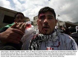Getty Images - MAJDAL SHAMS, ISRAEL - MAY 15: Blood runs down the head of an injured man as Palestinian protesters infiltrate the Israel-Syria border on May 15, 2011 near the Druze village of Majdal Shams, Israel. Reportedly at least twelve were killed and several injured when IDF soldiers open fired on protesters attempting to cross the Syria-Israel border adjacent to Majdal Shams in northern Israel. Palestinians today were remonstrating the establishment of Israel in 1948, termed 'Nakba Day.' 