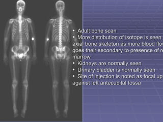 • Adult bone scan
Adult bone scan
• More distribution of isotope is seen
More distribution of isotope is seen i
axial bone skeleton as more blood flow
axial bone skeleton as more blood flow
goes their secondary to presence of re
goes their secondary to presence of re
marrow
marrow
• Kidneys are normally seen
Kidneys are normally seen
• Urinary bladder is normally seen
Urinary bladder is normally seen
• Site of injection is noted as focal upt
Site of injection is noted as focal upt
against left antecubital fossa
against left antecubital fossa
 