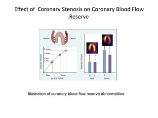 Effect of Coronary Stenosis on Coronary Blood Flow
Reserve
Illustration of coronary blood flow reserve abnormalities
 