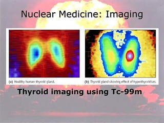 Nuclear Medicine: Imaging Thyroid imaging using Tc-99m 
