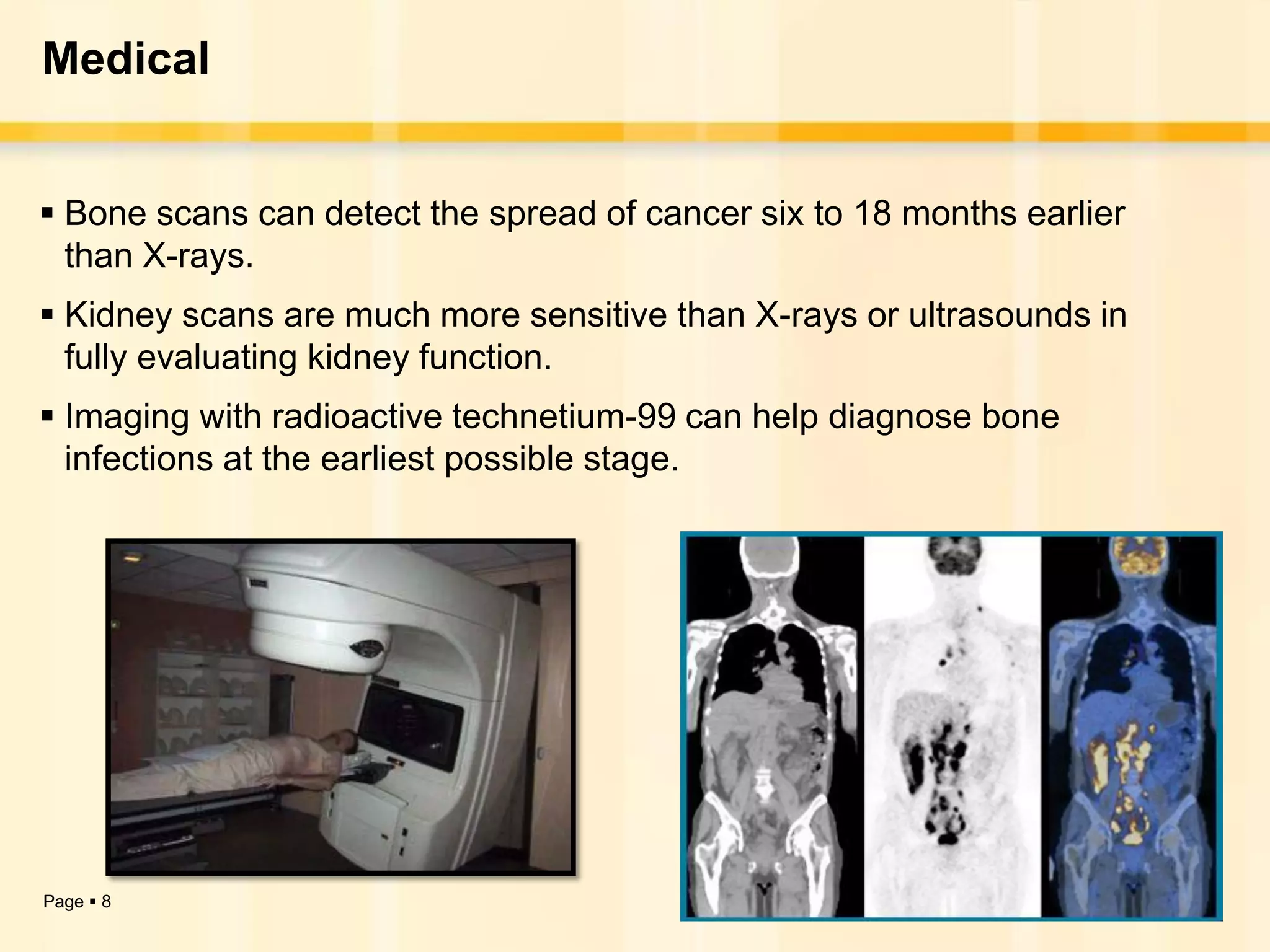 Medical


 Bone scans can detect the spread of cancer six to 18 months earlier
  than X-rays.
 Kidney scans are much more sensitive than X-rays or ultrasounds in
  fully evaluating kidney function.
 Imaging with radioactive technetium-99 can help diagnose bone
  infections at the earliest possible stage.




Page  8
 