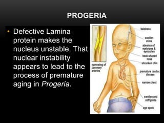 PROGERIA 
• Defective Lamina 
protein makes the 
nucleus unstable. That 
nuclear instability 
appears to lead to the 
process of premature 
aging in Progeria. 
 
