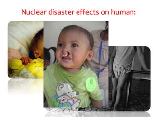 Nuclear disaster effects on human:
 