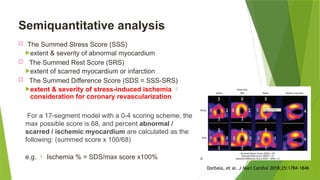 Sss Infarction Nuclear Imaging on cardiac vsacular carodac .pptx
