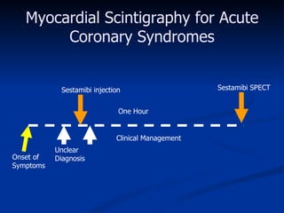 Myocardial Scintigraphy for Acute Coronary Syndromes Onset of  Symptoms Unclear Diagnosis Clinical Management Sestamibi injection Sestamibi SPECT One Hour 
