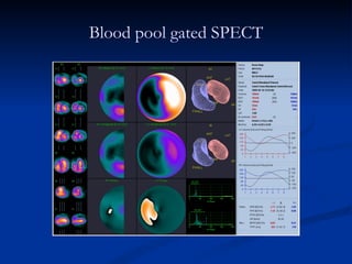 Blood pool gated SPECT 