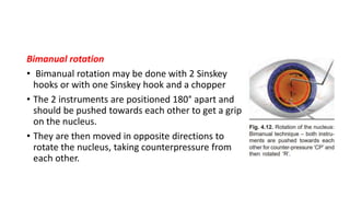 Rotate Instrument Phaco emulsification nuclear management techniques | PPTX
