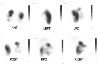Lpo Radiography Nuclear medicine | PPT