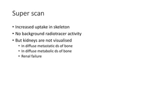 Super scan
• Increased uptake in skeleton
• No background radiotracer activity
• But kidneys are not visualised
• In diffuse metastatic ds of bone
• In diffuse metabolic ds of bone
• Renal failure
 