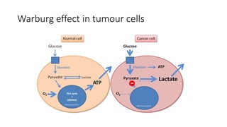 Warburg effect in tumour cells
 