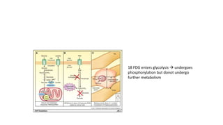 18 FDG enters glycolysis  undergoes
phosphorylation but donot undergo
further metabolism
 