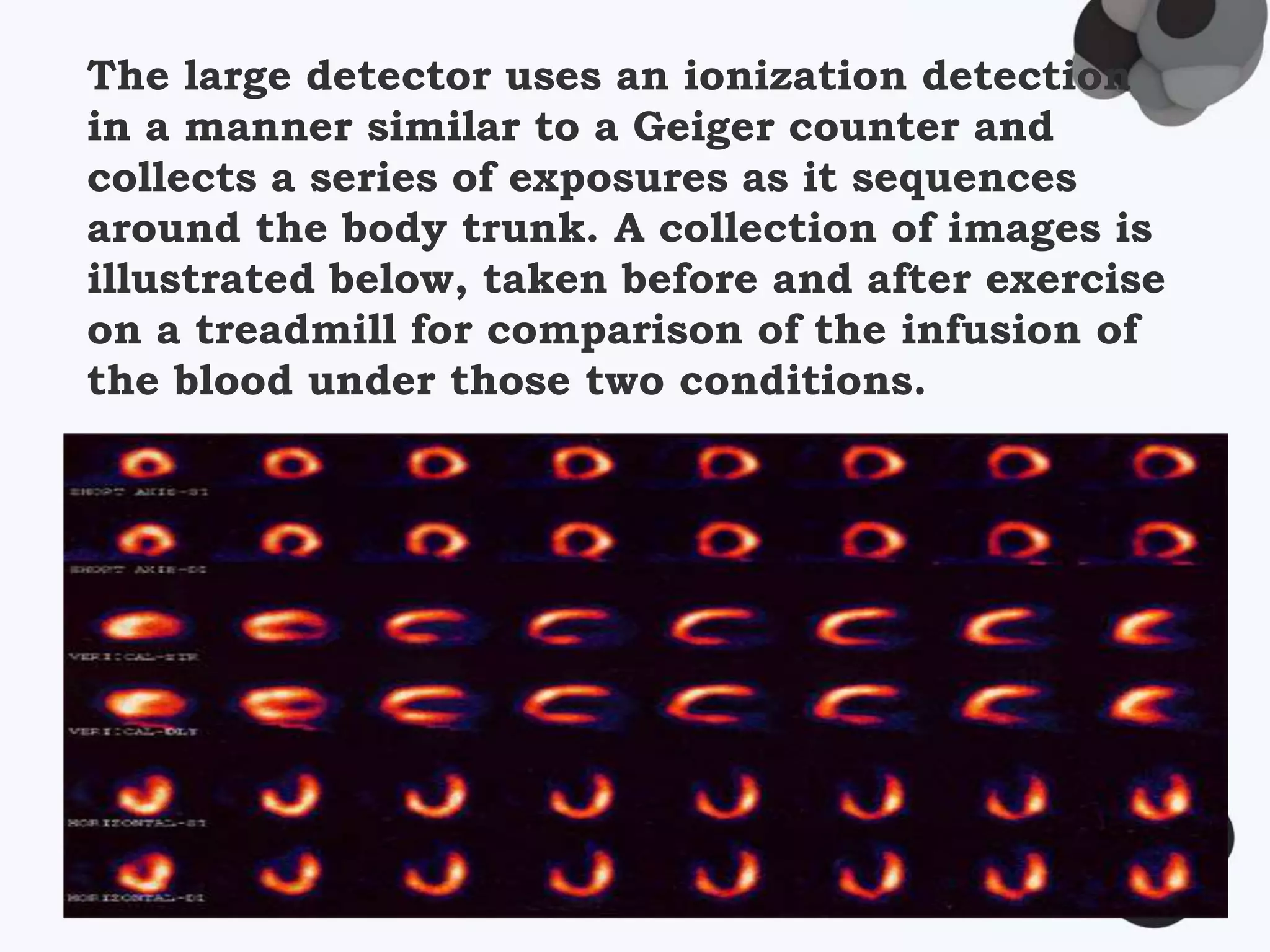 The large detector uses an ionization detection
in a manner similar to a Geiger counter and
collects a series of exposures as it sequences
around the body trunk. A collection of images is
illustrated below, taken before and after exercise
on a treadmill for comparison of the infusion of
the blood under those two conditions.
 
