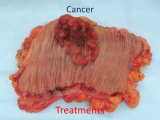 CancerTreatments