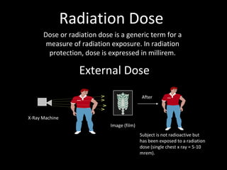 Radiation Dose
Dose or radiation dose is a generic term for a
measure of radiation exposure. In radiation
protection, dose is expressed in millirem.
X-Ray Machine
Image (film)
Subject is not radioactive but
has been exposed to a radiation
dose (single chest x ray = 5-10
mrem).
After
External Dose
 