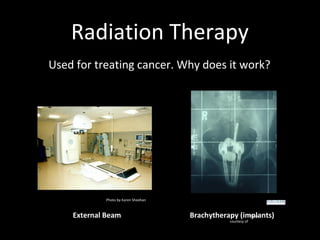 Radiation Therapy
Used for treating cancer. Why does it work?
External Beam Brachytherapy (implants)Image
courtesy of
Photo by Karen Sheehan
 