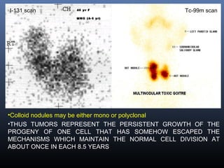 •Colloid nodules may be either mono or polyclonal
•THUS TUMORS REPRESENT THE PERSISTENT GROWTH OF THE
PROGENY OF ONE CELL THAT HAS SOMEHOW ESCAPED THE
MECHANISMS WHICH MAINTAIN THE NORMAL CELL DIVISION AT
ABOUT ONCE IN EACH 8.5 YEARS
Tc-99m scanI-131 scan
 