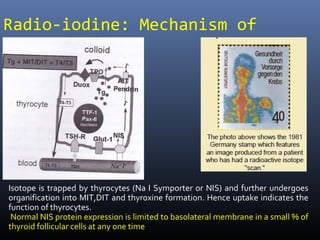 Isotope is trapped by thyrocytes (Na I Symporter or NIS) and further undergoes
organification into MIT,DIT and thyroxine formation. Hence uptake indicates the
function of thyrocytes.
Normal NIS protein expression is limited to basolateral membrane in a small % of
thyroid follicular cells at any one time
Radio-iodine: Mechanism of
uptake
 