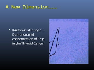 A New Dimension………
 Keston et al in 1942 :
Demonstrated
concentration of I-131
in theThyroid Cancer
 
