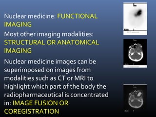 Nuclear medicine: FUNCTIONAL
IMAGING
Most other imaging modalities:
STRUCTURAL OR ANATOMICAL
IMAGING
Nuclear medicine images can be
superimposed on images from
modalities such as CT or MRI to
highlight which part of the body the
radiopharmaceutical is concentrated
in: IMAGE FUSION OR
COREGISTRATION
 