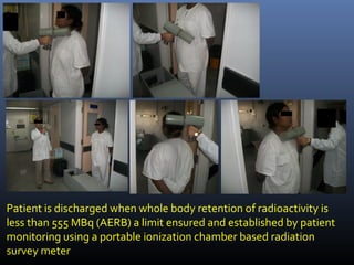 Patient is discharged when whole body retention of radioactivity is
less than 555 MBq (AERB) a limit ensured and established by patient
monitoring using a portable ionization chamber based radiation
survey meter
 