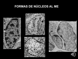 FORMAS DE NÚCLEOS AL ME
 