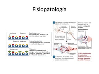 Fisiopatología
 