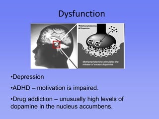 Drug addiction – unusually high levels of dopamine in the nucleus accumbens.Works CitedCrane, J., & Hannibal, J. (2009). Psychology: Course Companion. Oxford: 	Oxford University Press.Dubuc, B. (2002, September). The Pleasure Centres Affected by Drugs. In The 	Brain from Top to Bottom. Retrieved from http://thebrain.mcgill.ca/Fernandez-Espejo, E. (2000, May). How does the Nucleus Accumbens 	Function? In Pub Med [biomedical data base]. Retrieved from 	http://www.ncbi.nlm.nih.gov/‌pubmedHarmon, K. (2010, February 24). Surprised? How the Brain Records Memories 	of the Unexpected. In The Scientific American. Retrieved from 	http://www.scientificamerican.com