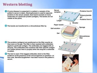 Western blotting
 