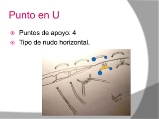 Punto en U
 Puntos de apoyo: 4
 Tipo de nudo horizontal.
 