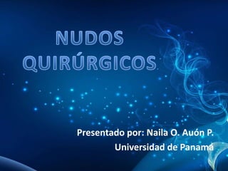 Presentado por: Naila O. Auón P.
Universidad de Panamá
 