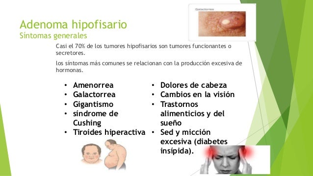 síntomas de diabetes hipofisarios
