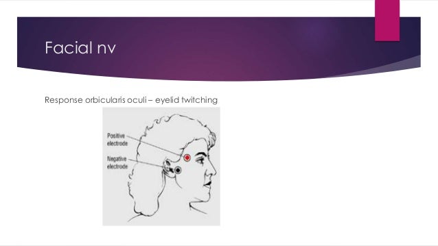 Nueromuscular monitoring