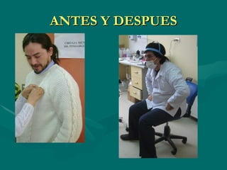 ANTES Y DESPUES 