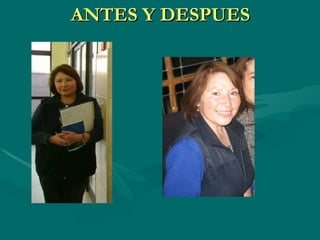 ANTES Y DESPUES 
