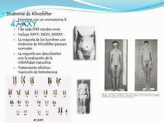 47,XXY
 Síndrome de Klinefelter
 Hombres con un cromosoma X
extra
 1 de cada 500 nacidos vivos
 Incluye XXYY, XXXY, XXXXY
 La mayoría de los hombres con
síndrome de Klinefelter parecen
normales
 La mayoría son descubiertos
con la evaluación de la
infertilidad masculina
 Tratamiento efectivo.
Inyección de testosterona
 